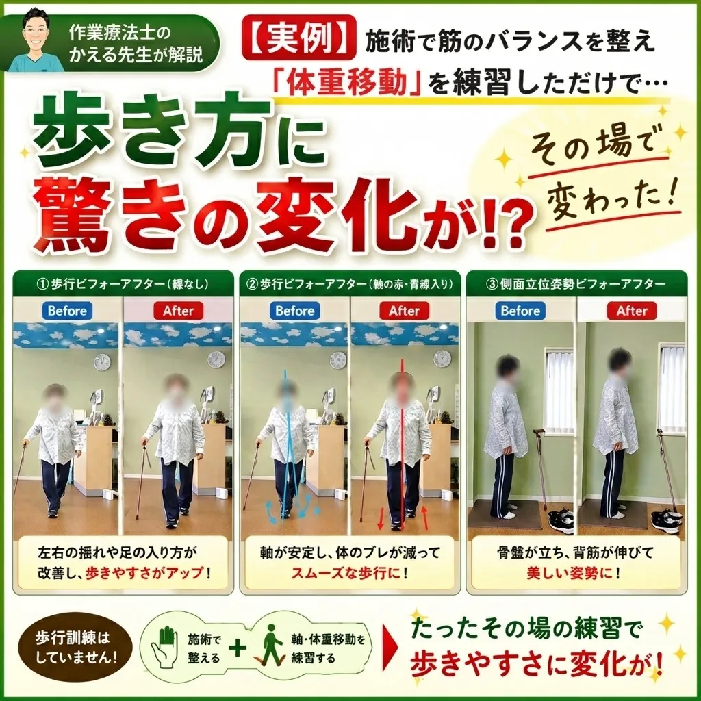 【実例】施術で身体を整え「体重移動」を練習しただけで…歩き方に驚きの変化!?